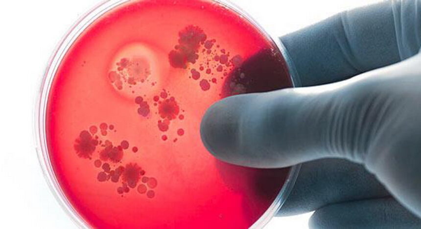 Σχετικά με τον θόρυβο για το κρούσμα μηνιγγίτιδας στο Χαϊδάρι 2 Σχετικά με τον θόρυβο για το κρούσμα μηνιγγίτιδας στο Χαϊδάρι 1