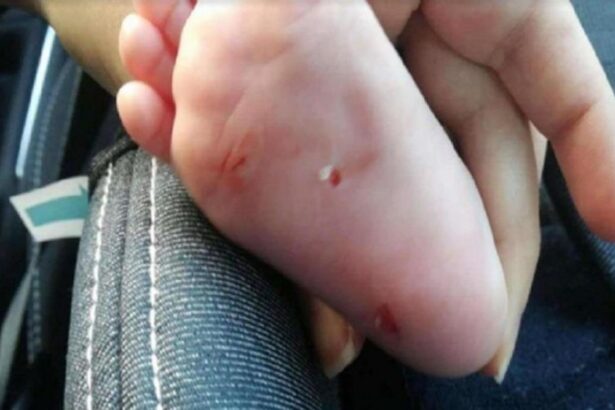 Στο Δρομοκαΐτειο η 55χρονη που κατηγορείται ότι τραυμάτιζε μωρά 33