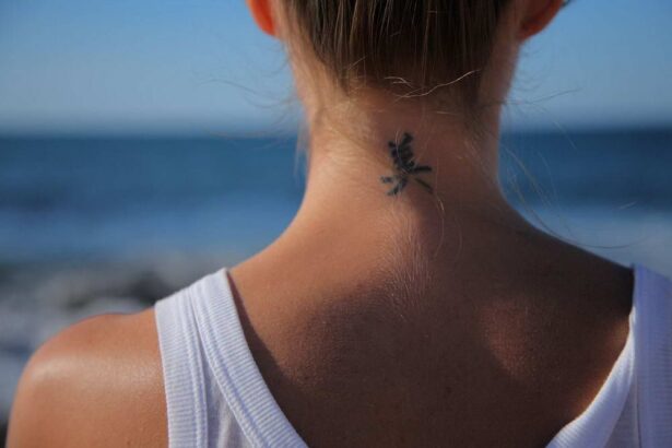 αφαίρεση tattoo