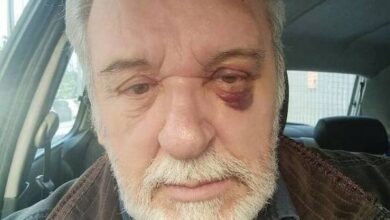Το μαυρισμένο μάτι του Τάσου Χαλκιά: "Βάλε φυλαχτά, σε γλωσσοτρώνε" 7
