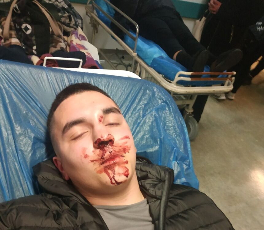 Στο νοσοκομείο 17χρονος Χαϊδαριώτης από επίθεση συμμορίας - Αναζήτηση των ενόχων 1