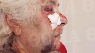 Ληστές ξυλοκόπησαν άγρια 80χρονη στo Αιγάλεω, της έσκισαν τα αυτιά για να της πάρουν τα σκουλαρίκια 9