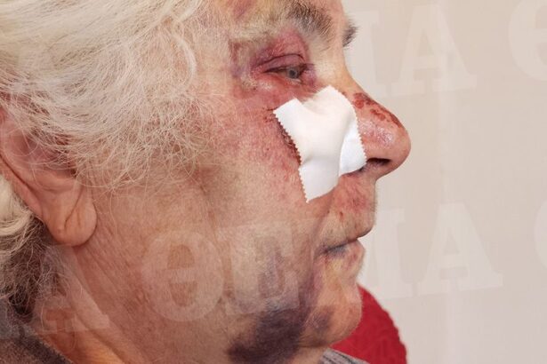 Συνελήφθη 21χρονος για τη ληστεία και τον βασανισμό 80χρονης στο Αιγάλεω 7