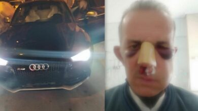 Χτύπησε τον πατέρα μου επειδή του είπε για το παρκάρισμα... 19