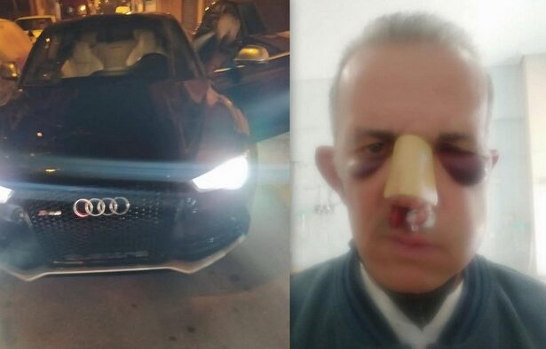 Χτύπησε τον πατέρα μου επειδή του είπε για το παρκάρισμα... 19