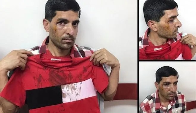 Καταγγελία για ρατσιστική επίθεση στο Περιστέρι 2 Καταγγελία για ρατσιστική επίθεση στο Περιστέρι 1