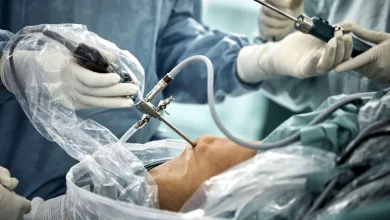 Ορθοπαιδική: Διαμορφώνοντας το μέλλον της αρθροσκόπησης γόνατος στην Ελλάδα 26