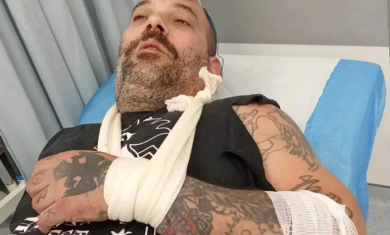 Ο Τάκης Χήρας θύμα τροχαίου με εγκατάλειψη στη Λεωφόρο Ποσειδώνος 2 Ο Τάκης Χήρας θύμα τροχαίου με εγκατάλειψη στη Λεωφόρο Ποσειδώνος 1