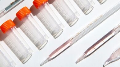 Δωρεάν μικροβιολογικές εξετάσεις από τον Δήμο Χαϊδαρίου 7