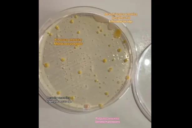 Τα μικρόβια του Μετρό της Αθήνας - Τι εντόπισε Ελληνίδα βιολόγος 49