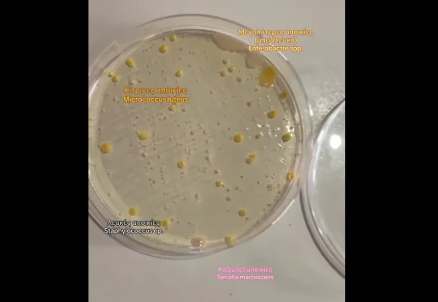 Τα μικρόβια του Μετρό της Αθήνας - Τι εντόπισε Ελληνίδα βιολόγος 2 Τα μικρόβια του Μετρό της Αθήνας - Τι εντόπισε Ελληνίδα βιολόγος 1