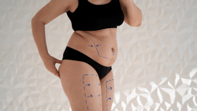 Bikini Ready με Λιποαναρρόφηση Κοιλιάς: Οι πιο Σύγχρονες Τεχνικές για Αφαίρεση Λίπους σε Προσιτό Κόστος 1