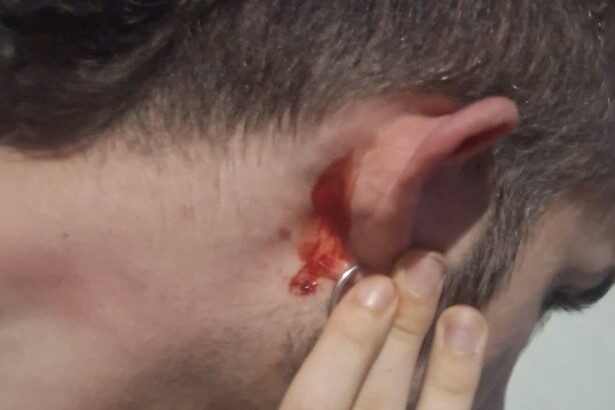 24χρονος καταγγέλλει ξυλοδαρμό με ομοφοβικά κίνητρα 49