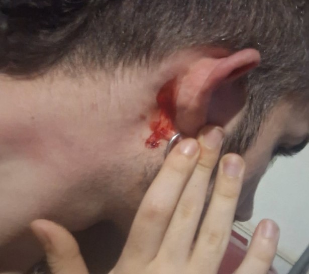 24χρονος καταγγέλλει ξυλοδαρμό με ομοφοβικά κίνητρα 1