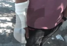 Τρελός καυγάς για μια θέση πάρκινγκ - "Έβαλα το δάχτυλό του στο ψυγείο!" 244