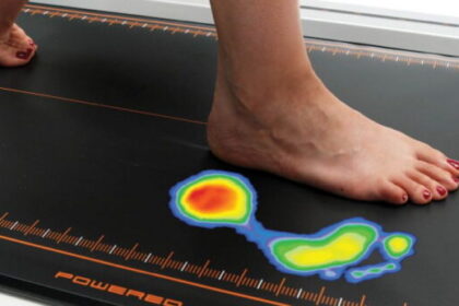 Δωρεάν πελματογράφημα από τον Δήμο Χαϊδαρίου  105