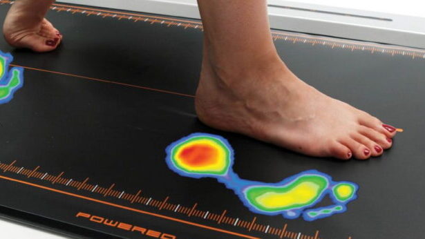 Δωρεάν πελματογράφημα από τον Δήμο Χαϊδαρίου  113