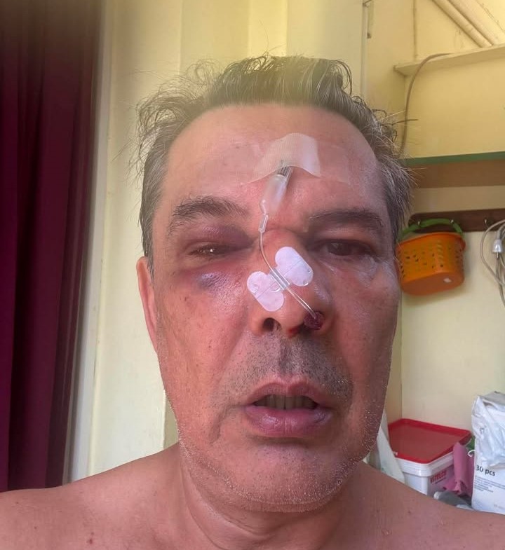 Σοκαριστικός διπλός ξυλοδαρμός πολίτη σε ιατρείο, για ασήμαντο λόγο 15